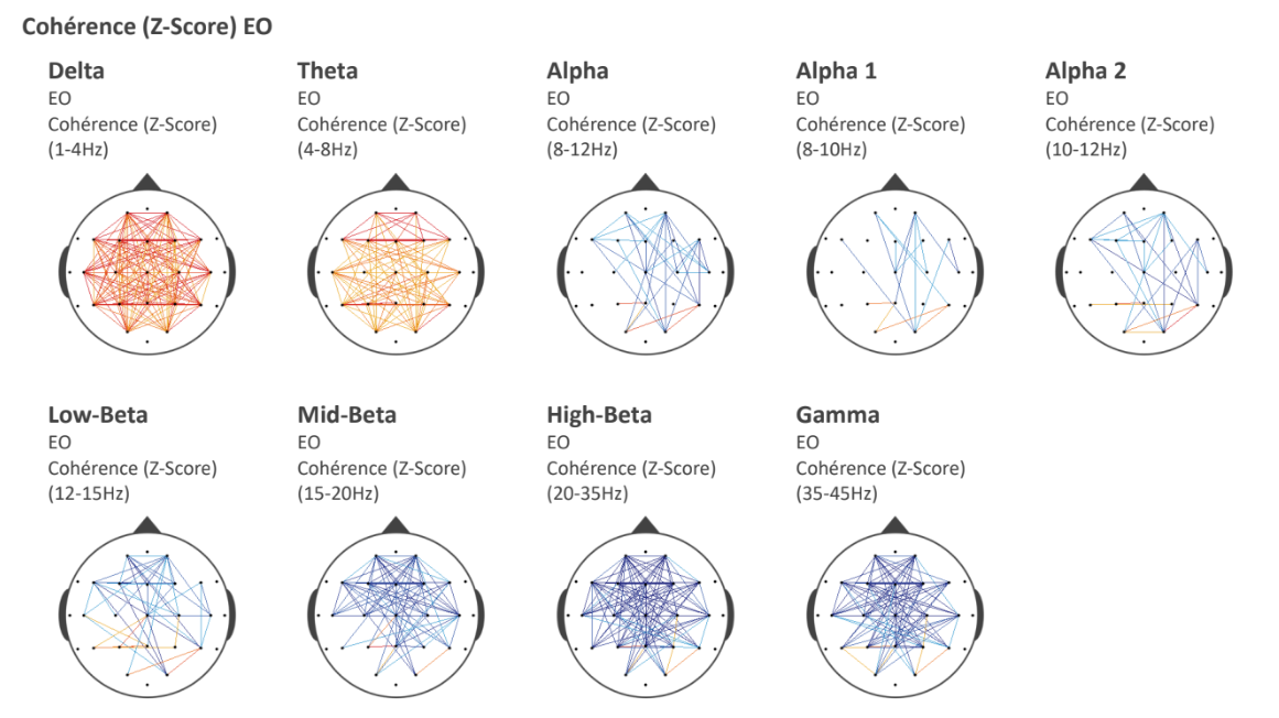 Cartes de cohérence qEEG entre différentes régions